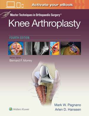 Master Techniques In Orthopedic Surgery Knee Arthroplasty